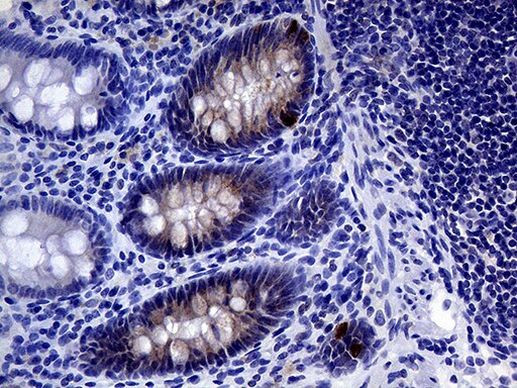 IL24 Antibody in Immunohistochemistry (Paraffin) (IHC (P))