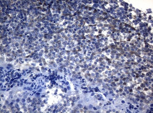 ADH5 Antibody in Immunohistochemistry (Paraffin) (IHC (P))