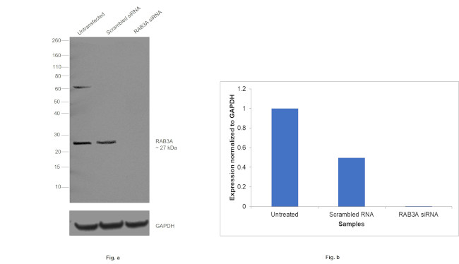 RAB3A Antibody in Western Blot (WB)