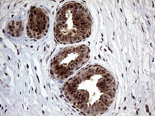 GLS2 Antibody in Immunohistochemistry (Paraffin) (IHC (P))