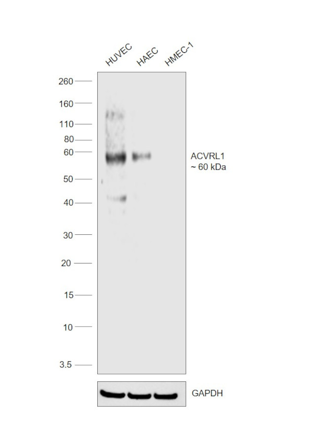 ACVRL1 Antibody in Western Blot (WB)