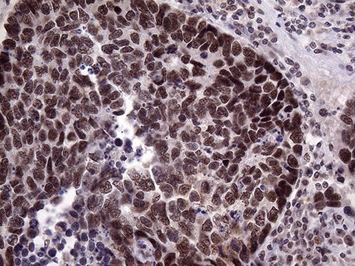 LHX4 Antibody in Immunohistochemistry (Paraffin) (IHC (P))