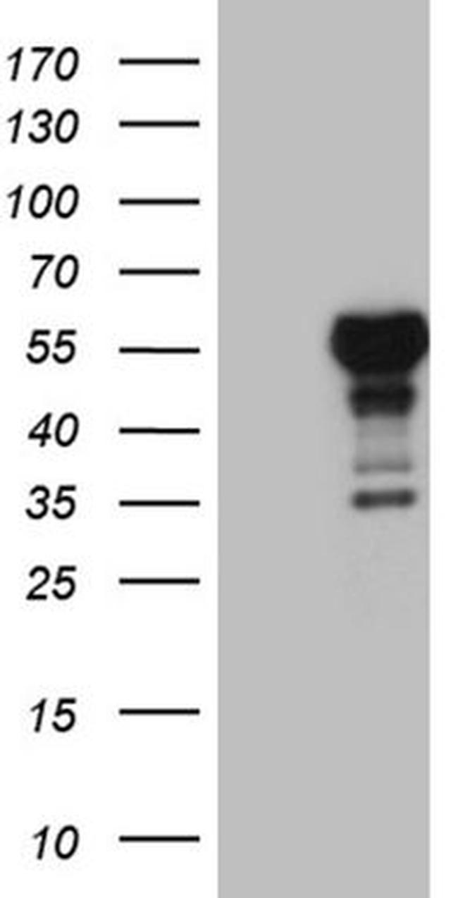 LHX4 Antibody in Western Blot (WB)