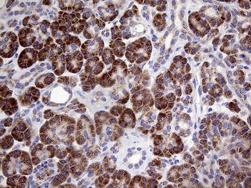 Myotilin Antibody in Immunohistochemistry (Paraffin) (IHC (P))