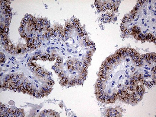 Myotilin Antibody in Immunohistochemistry (Paraffin) (IHC (P))