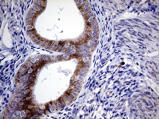 Myotilin Antibody in Immunohistochemistry (Paraffin) (IHC (P))