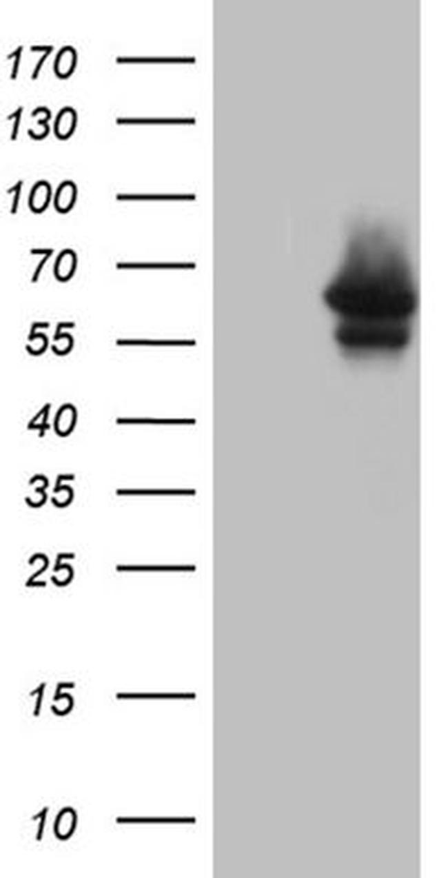 Myotilin Antibody in Western Blot (WB)