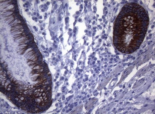 SYNC Antibody in Immunohistochemistry (Paraffin) (IHC (P))