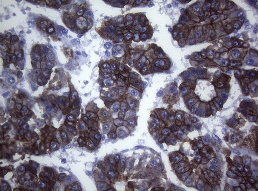 SYNC Antibody in Immunohistochemistry (Paraffin) (IHC (P))