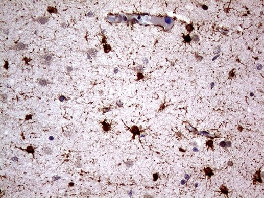 NPAS1 Antibody in Immunohistochemistry (Paraffin) (IHC (P))