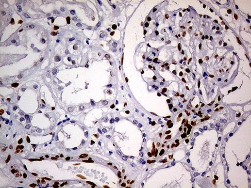 MEIS1 Antibody in Immunohistochemistry (Paraffin) (IHC (P))