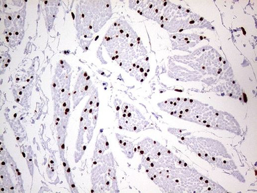 MEIS1 Antibody in Immunohistochemistry (Paraffin) (IHC (P))