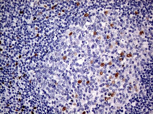 MEIS1 Antibody in Immunohistochemistry (Paraffin) (IHC (P))