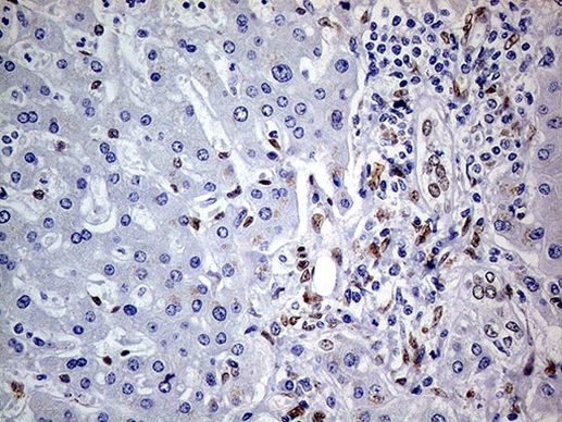 MEIS1 Antibody in Immunohistochemistry (Paraffin) (IHC (P))