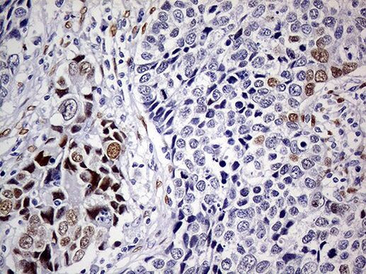 MEIS1 Antibody in Immunohistochemistry (Paraffin) (IHC (P))