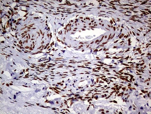 MEIS1 Antibody in Immunohistochemistry (Paraffin) (IHC (P))