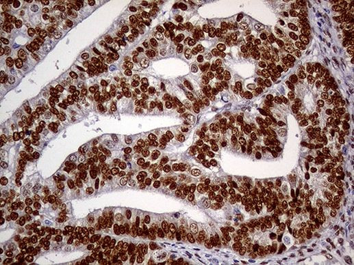 MEIS1 Antibody in Immunohistochemistry (Paraffin) (IHC (P))