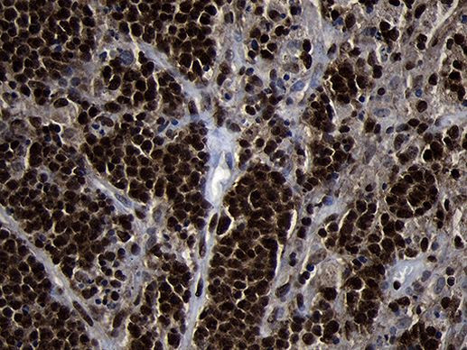 HOXC4 Antibody in Immunohistochemistry (Paraffin) (IHC (P))