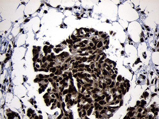 HOXC4 Antibody in Immunohistochemistry (Paraffin) (IHC (P))