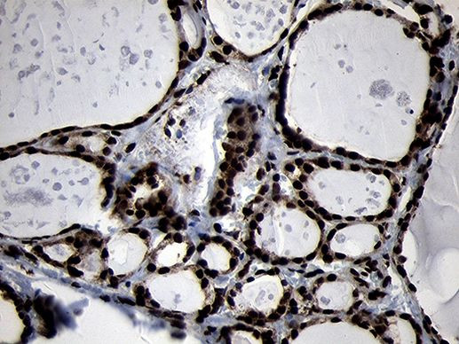 HOXC4 Antibody in Immunohistochemistry (Paraffin) (IHC (P))