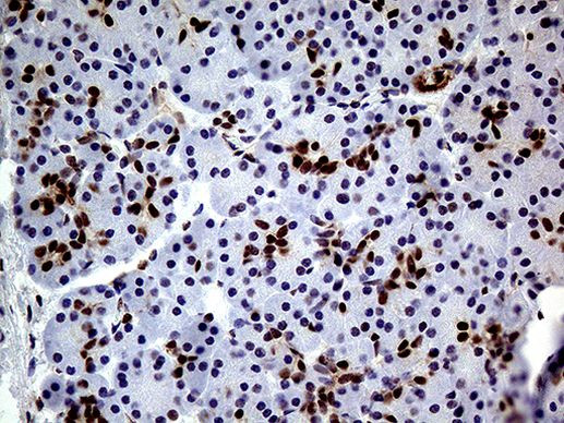 TCF12 Antibody in Immunohistochemistry (Paraffin) (IHC (P))