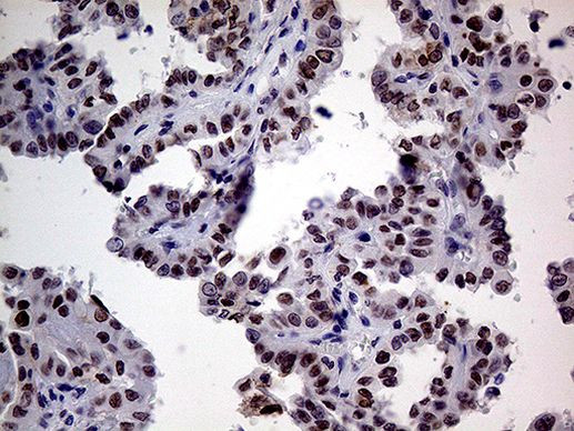 TCF12 Antibody in Immunohistochemistry (Paraffin) (IHC (P))