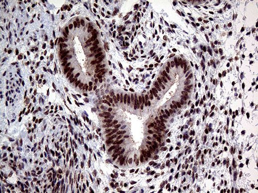 TCF12 Antibody in Immunohistochemistry (Paraffin) (IHC (P))