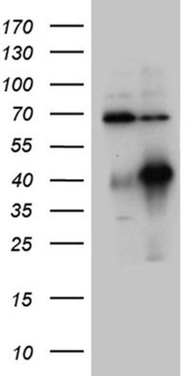 HOXC4 Antibody in Western Blot (WB)