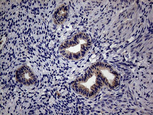 TRIP13 Antibody in Immunohistochemistry (Paraffin) (IHC (P))