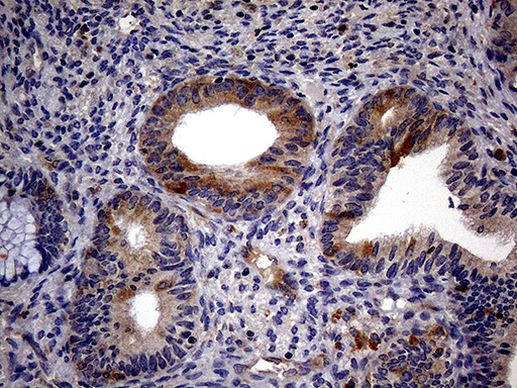 TRIP13 Antibody in Immunohistochemistry (Paraffin) (IHC (P))