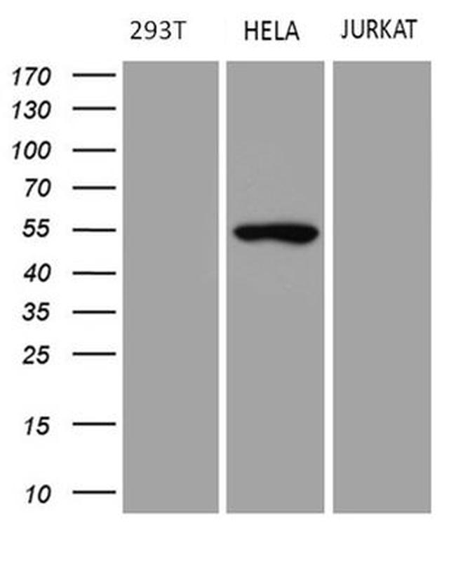 TRIP13 Antibody in Western Blot (WB)