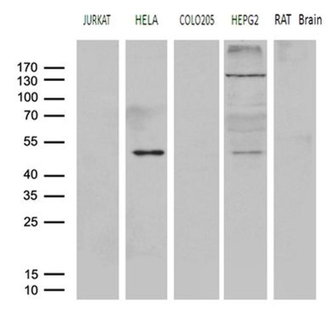 AGPAT9 Antibody in Western Blot (WB)