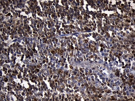 PDCL3 Antibody in Immunohistochemistry (Paraffin) (IHC (P))