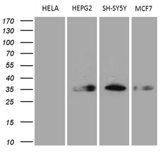 CBR1 Antibody in Western Blot (WB)