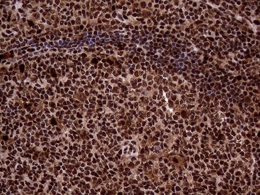 TALDO1 Antibody in Immunohistochemistry (Paraffin) (IHC (P))