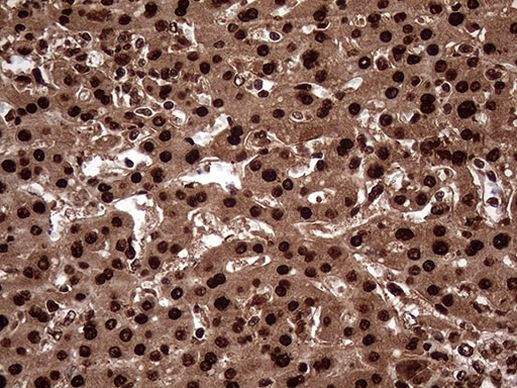 TALDO1 Antibody in Immunohistochemistry (Paraffin) (IHC (P))