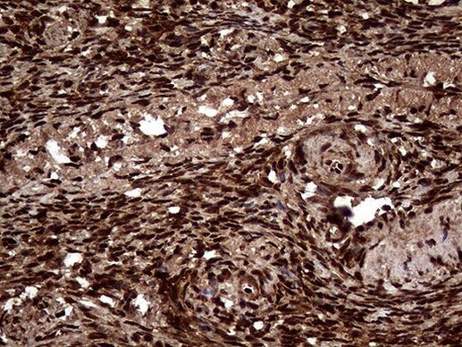 TALDO1 Antibody in Immunohistochemistry (Paraffin) (IHC (P))