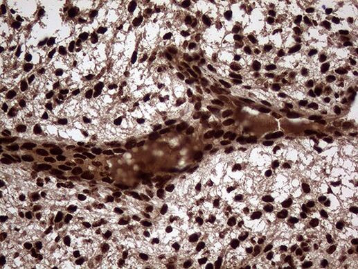 TALDO1 Antibody in Immunohistochemistry (Paraffin) (IHC (P))