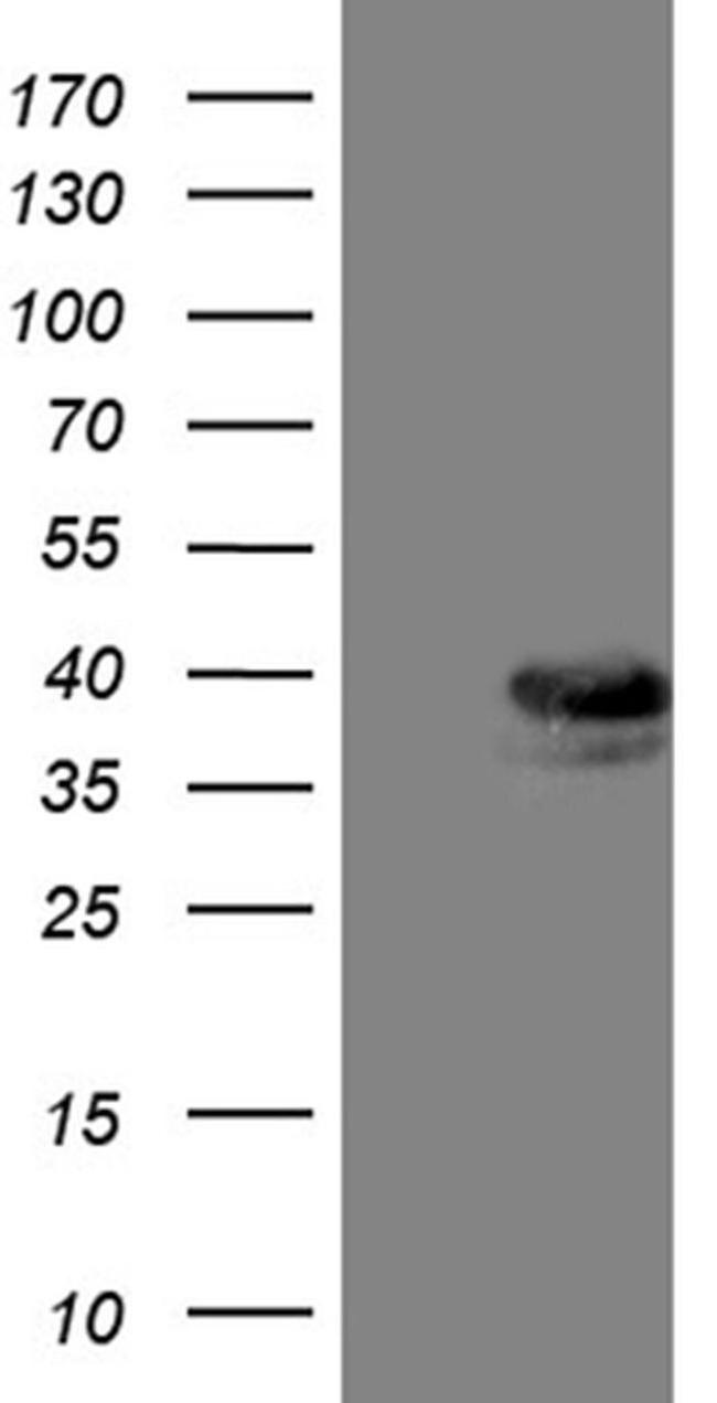 TALDO1 Antibody in Western Blot (WB)