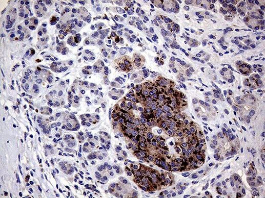 AMDHD1 Antibody in Immunohistochemistry (Paraffin) (IHC (P))