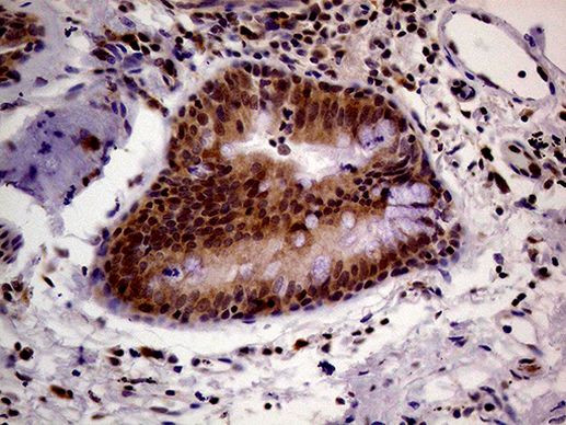 PCMT1 Antibody in Immunohistochemistry (Paraffin) (IHC (P))