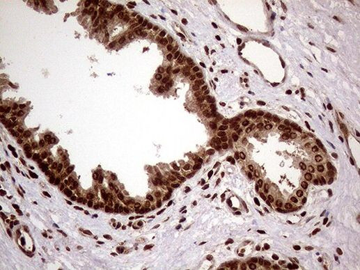 DDX19A Antibody in Immunohistochemistry (Paraffin) (IHC (P))