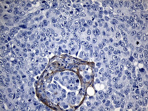 ROR2 Antibody in Immunohistochemistry (Paraffin) (IHC (P))