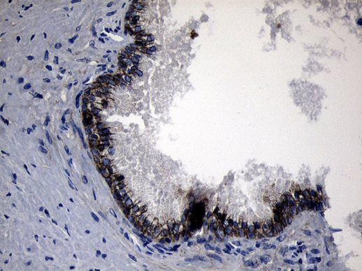 ROR2 Antibody in Immunohistochemistry (Paraffin) (IHC (P))