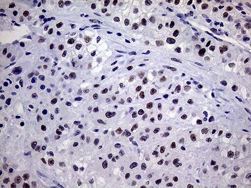 TSEN34 Antibody in Immunohistochemistry (Paraffin) (IHC (P))