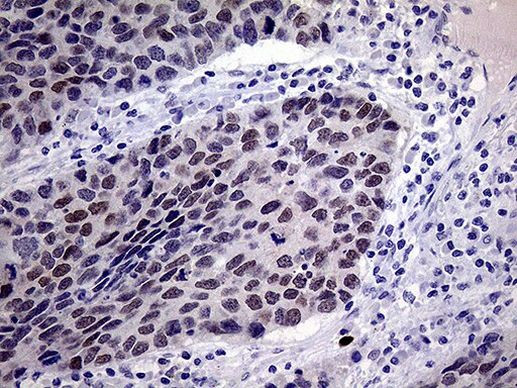 TSEN34 Antibody in Immunohistochemistry (Paraffin) (IHC (P))