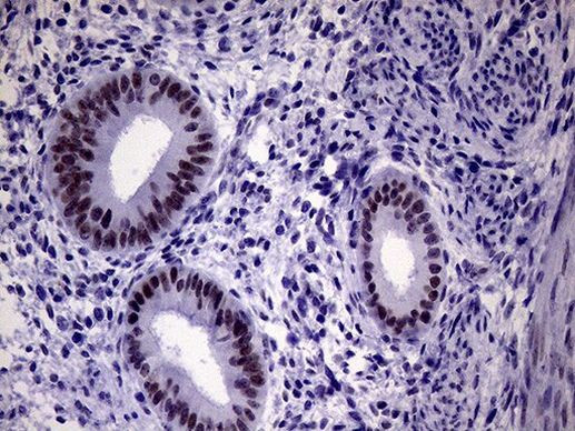 TSEN34 Antibody in Immunohistochemistry (Paraffin) (IHC (P))