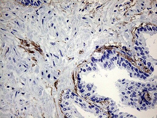 ZRANB1 Antibody in Immunohistochemistry (Paraffin) (IHC (P))