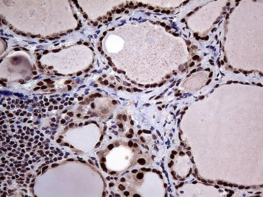 PPP4C Antibody in Immunohistochemistry (Paraffin) (IHC (P))