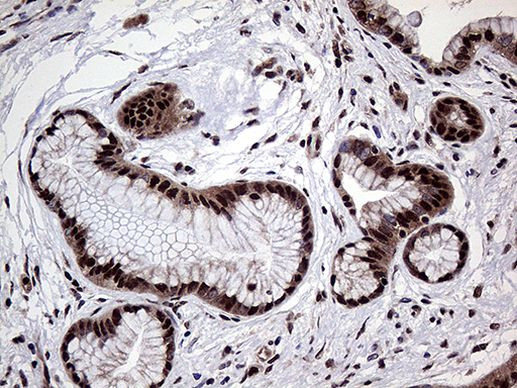 PPP4C Antibody in Immunohistochemistry (Paraffin) (IHC (P))